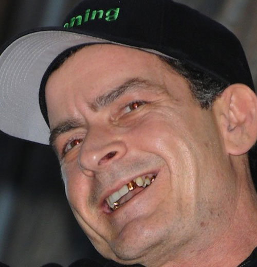 A Coked Out Charlie Sheen Allegedly Pulled A Knife On His Dentist (UPDATE)