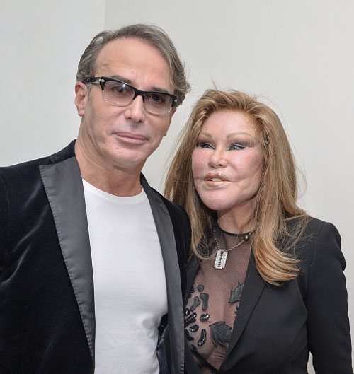 I Guess It Was Jocelyn Wildenstein’s Man’s Turn To Get Arrested For Being A Violent Mess