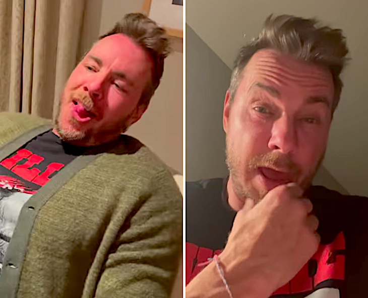 Open Post: Hosted By Dax Shepard Having The Hiccups For 50 Hours Straight