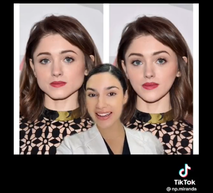 A Cosmetic Aesthetician Apologized For Showing What She’d Change About Natalia Dyer’s Face