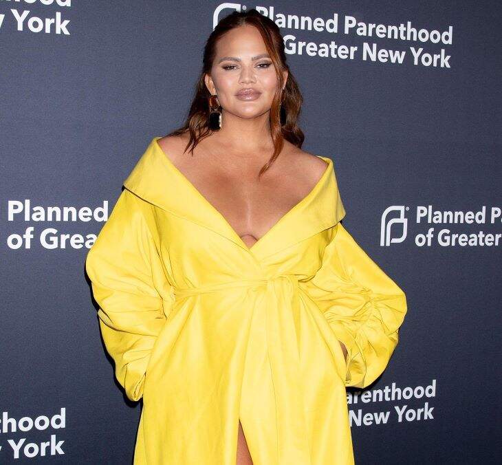 Chrissy Teigen Posted A Picture Of Her C-Section In Response To Accusations On Social Media That A Surrogate Carried Her Youngest Baby